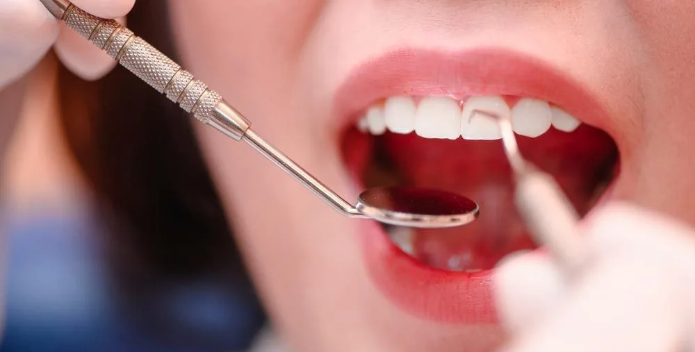 Dentist examining a patient's teeth — dental clinic in Buderim, QLD