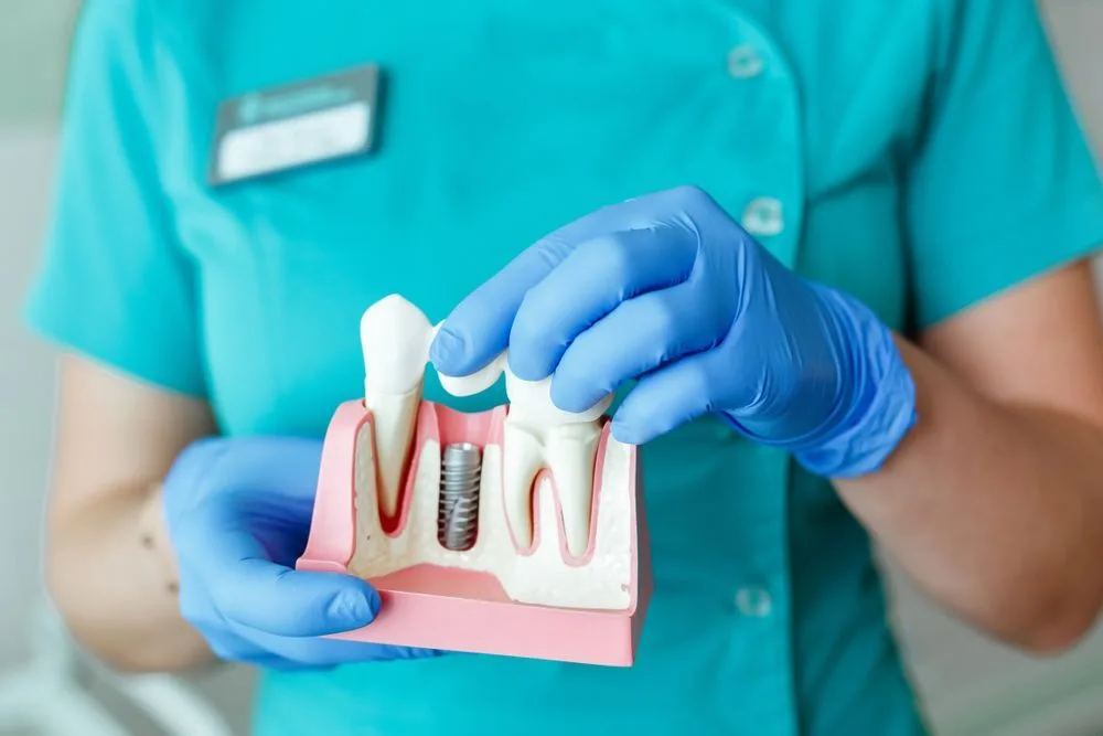 Dentist holding a model of a tooth with an implant — dental clinic in Buderim, QLD