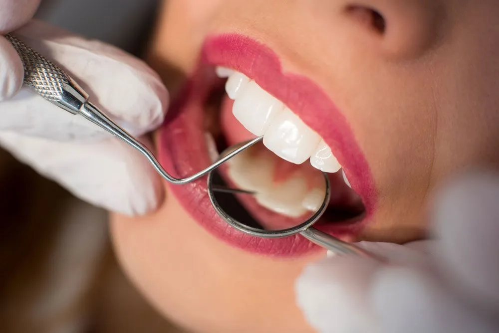 Dentist performing a dental check-up on a smiling patient — dental clinic in Buderim, QLD