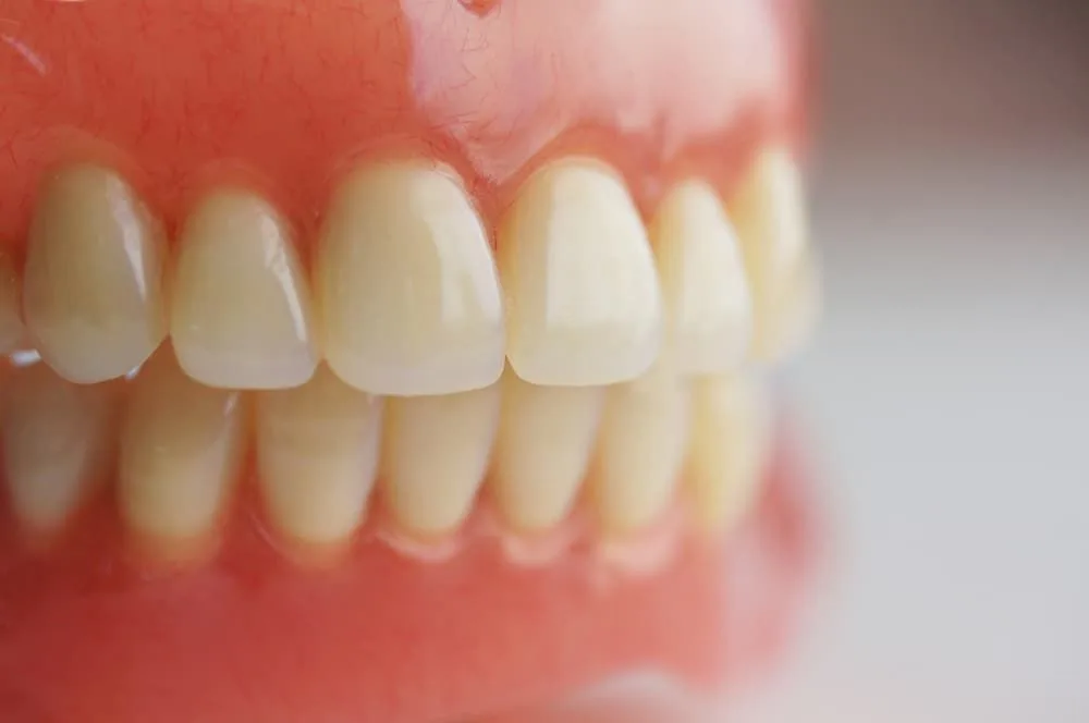 Close-up of a set of dentures — dental clinic in Buderim, QLD
