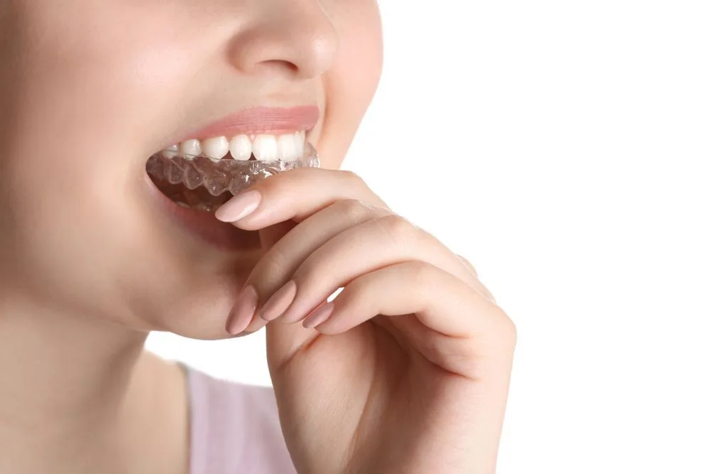 Woman putting an occlusal splint in her mouth — dental clinic in Buderim, QLD