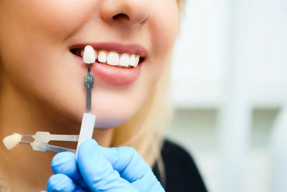 Beautiful smile and white teeth of a young woman — dental clinic in Buderim, QLD